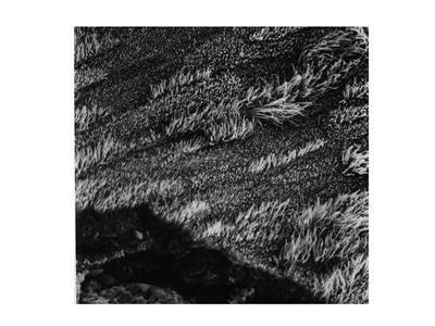 Scanning electron micrograph of cilia on the surface of a tissue engineered construct